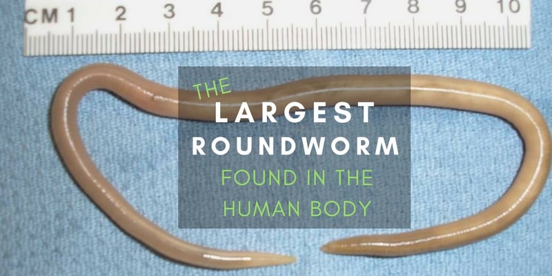 Human parasite worms - ASCARIS
