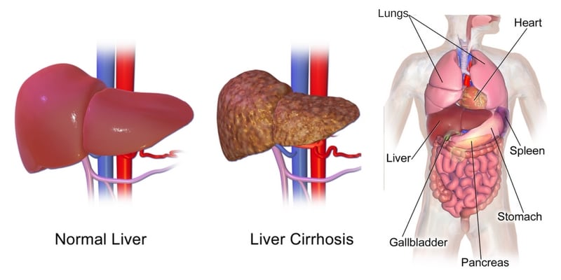 Liver Cleanse in 4 Easy Steps